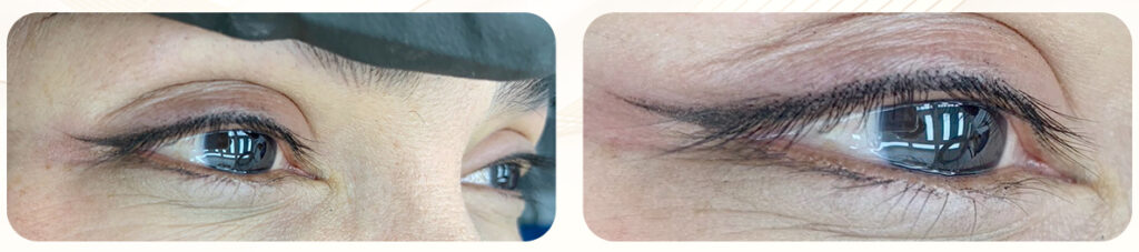 สักอินไลน์เนอร์ จี้ไฝ ต่อขนตา